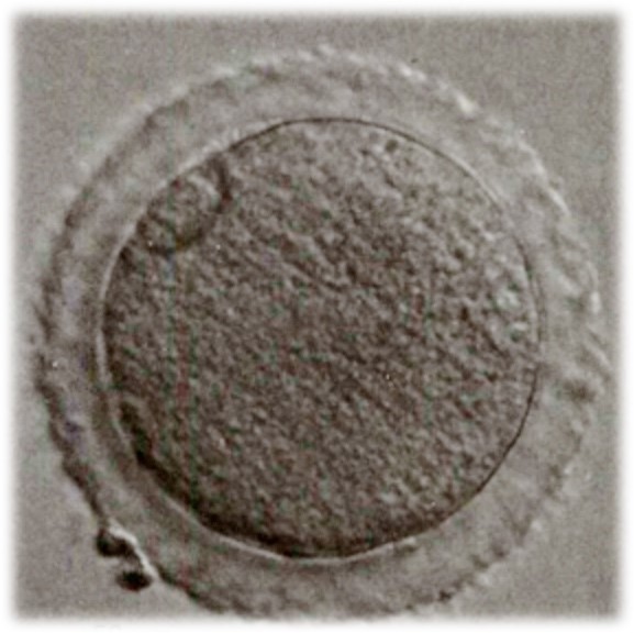 8. 遇到蜡样透明带卵母细胞如何应对？对于妊娠结局有什么影响？