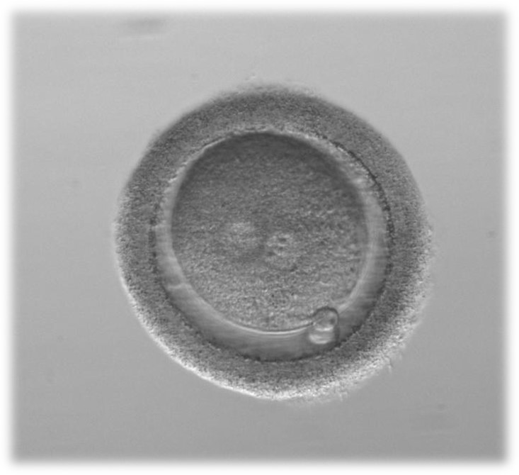 3. 棕色透明带（透明带颜色较深）是否影响胚胎发育，这部分患者的共同特点是什么，有无改善措施，移植前是否需要辅助孵化？